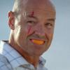 Guy with an orange slice smile